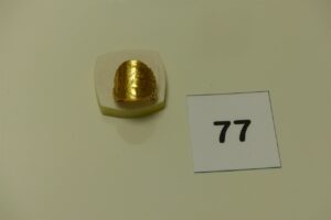 1 bague en or monture à décor floral sertie d'une pièce de 20Frs retournée (Td56). PB 11g